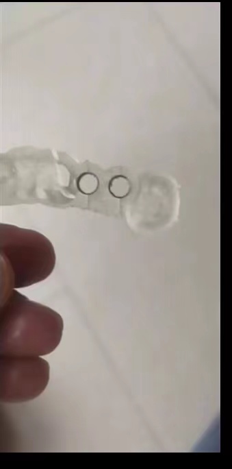 Resin Dental 3D Printer Planti - 3D Printing Dental บทวิจารณ์และราคา