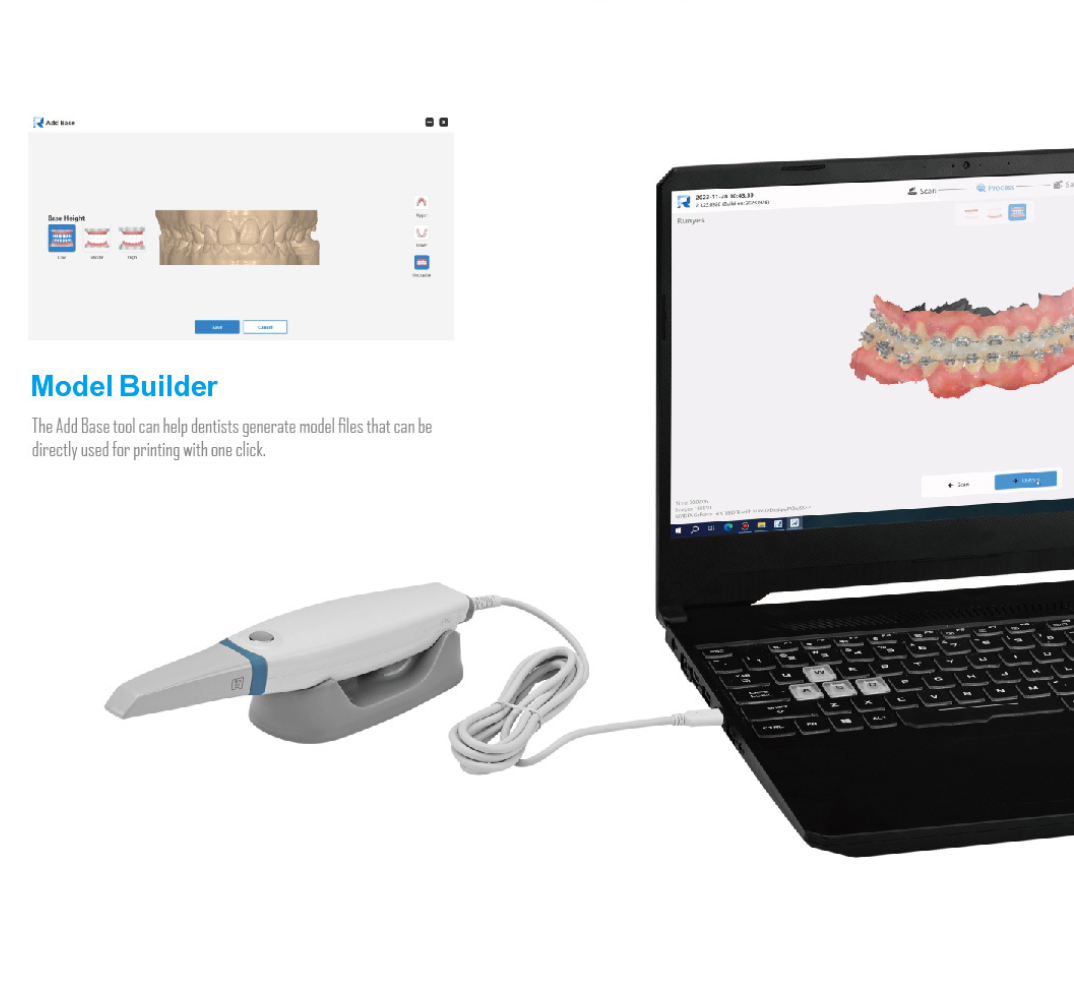 2026 NEW Dental Intraoral Scan - 3D Printing Dental บทวิจารณ์และราคา